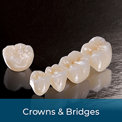 Restore damaged teeth with strong and aesthetic dental crowns.